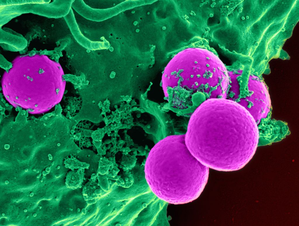 Human_neutrophil_ingesting_MRSA