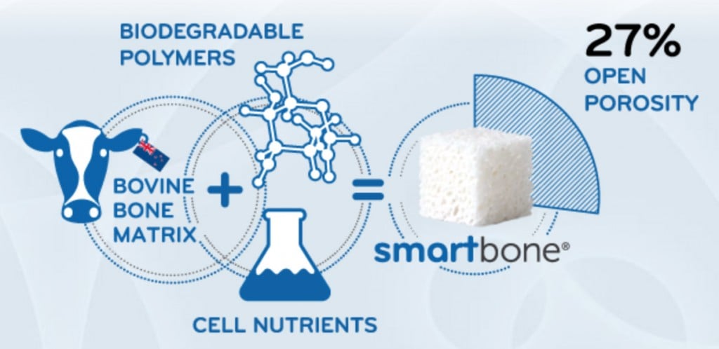 smartbone