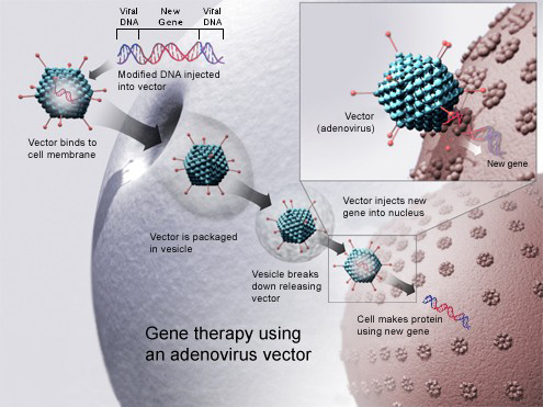 Gene therapy