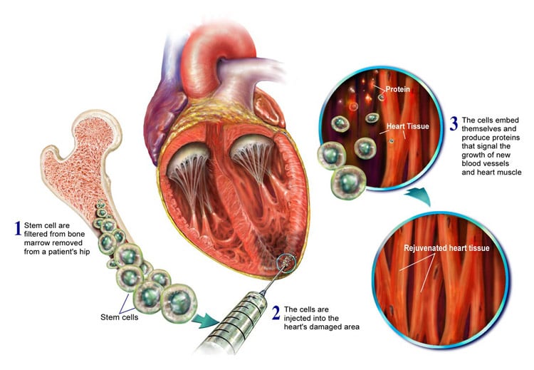 Source: McGowan Institute for Regenerative Medicine