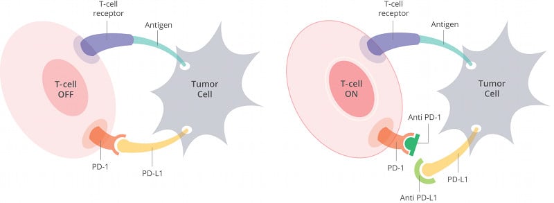 Genentech's Atezolizumab works as a mAb PD-L1 Inhibitor in killing NSCLC tumor cells (CC: Smart Patients)