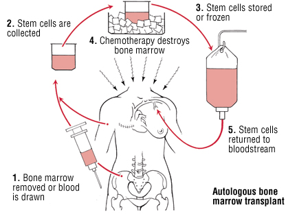 Source: Harvard Health Publications