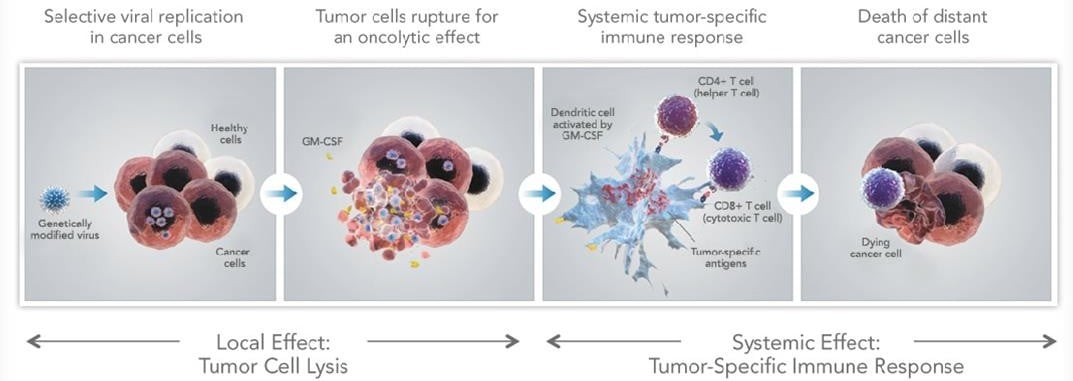 Delivery of T-VEC via the OncoVex viral vector stmulates antigen ((Source: Amgen)