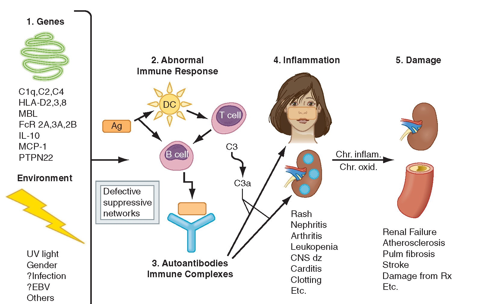 An overview of the pathophysiology behind systemic lupus erythematosus - SLE (Source: What when how)