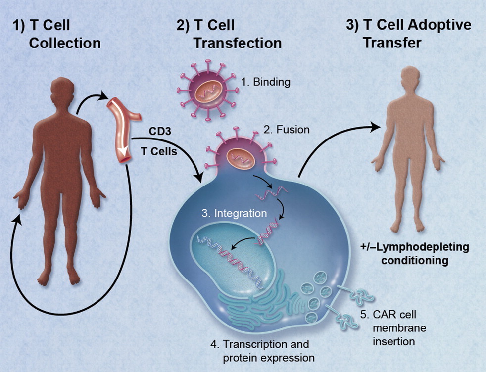 CAR-Engineered_T-Cell_Adoptive_Transfer - edited