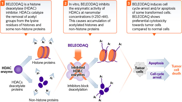 beleodaq_cancer_onxeo_lymphoma