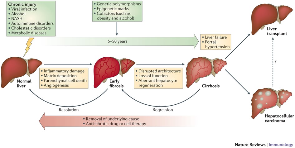 elafibrinor_nash_genfit_nature