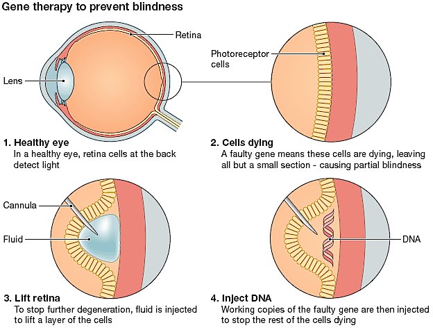 (Source: Oxford University)