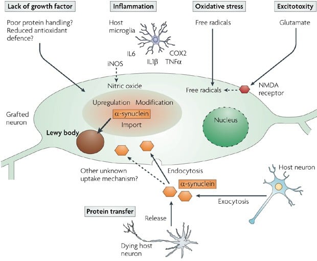 parkinson_lewy_body_causes_mechanism_CNS