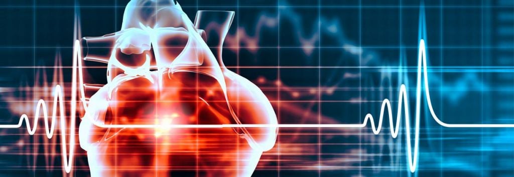 regeneron sanofi praulant odyssey alirocumab cardiac statins