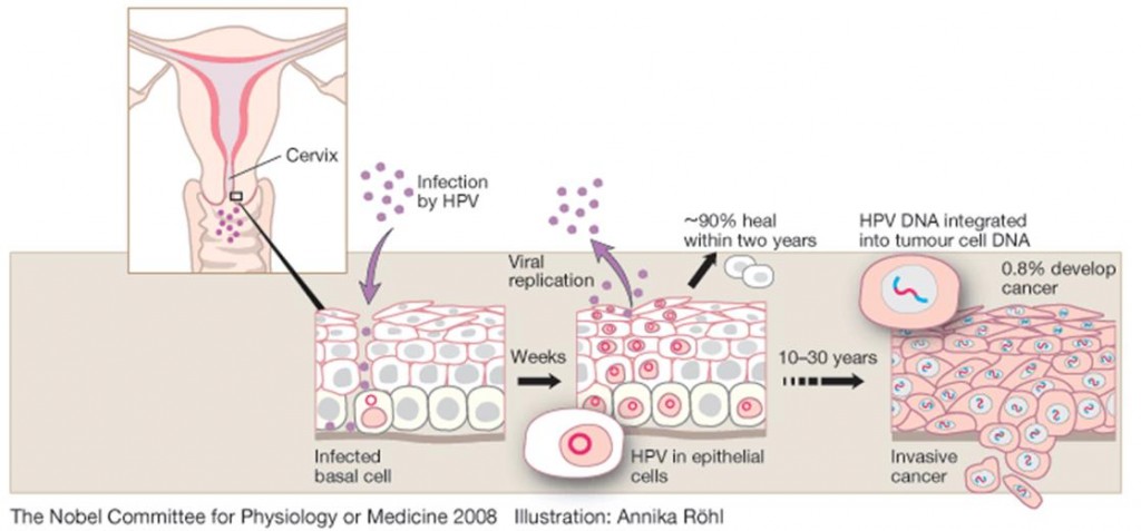 HPV_cancer_dutch_swiss_inthera_alglaia_oncology_solid_hypoxia_cervical