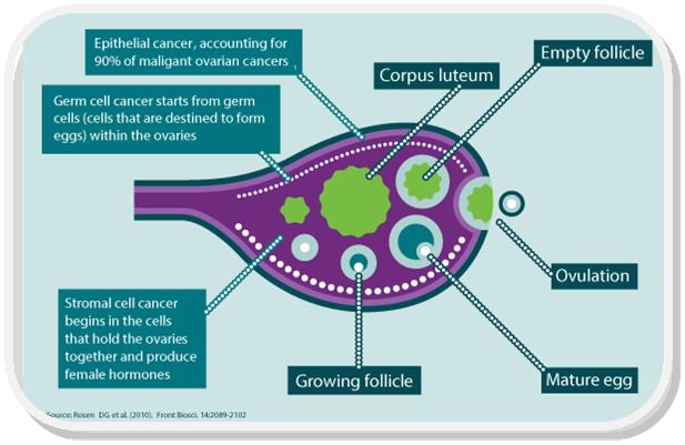 _cancer_gamamabs_AMHII_types