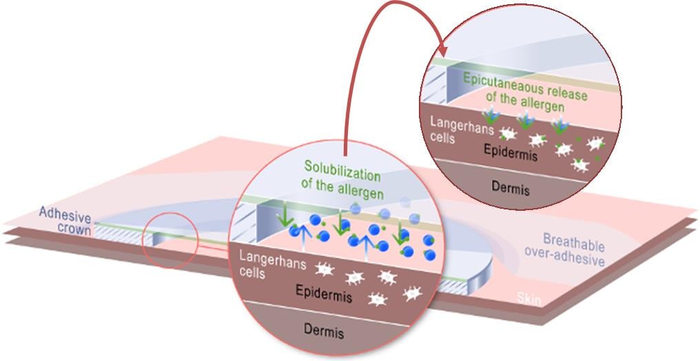 peanut_viaskin_patch_allergies_dbv_technologies