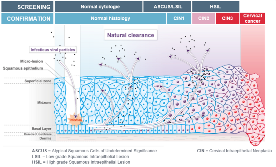 HPV_cervical_cancer_genticel