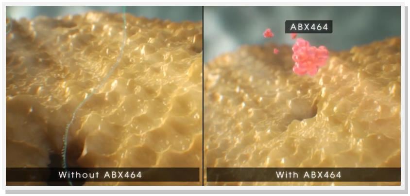 abivax_hiv_antiviral_phase_II_rna_abx464