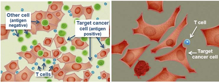 immtac_immunocore_uveal_cancer_eye