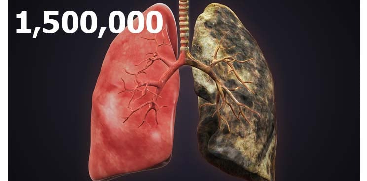 lung_cancer_carcinoma_small_Cell_deadliest_biotech_therapies