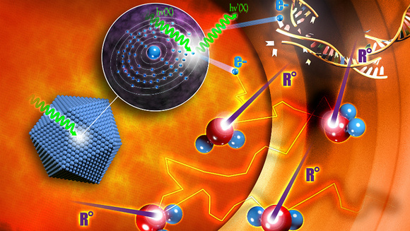 nanobiotix_radiotherapy_trial_prostate_cancer_nanomedicine