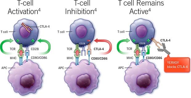 yervoy_md_anderson_cancer_mologen copia