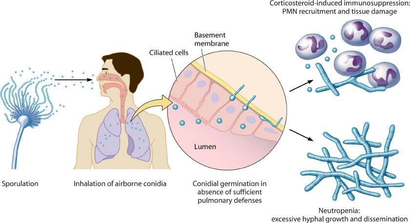 MATHIAS_Infectious-life-cycle-of-A-fumigatus-Aspergillus-is-ubiquitous-in-the