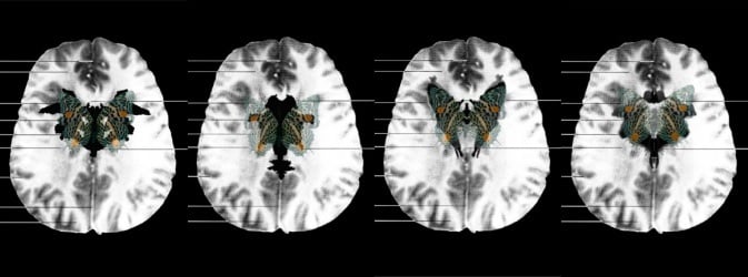 suzanne_anker_mri_butterfly_neuroculture_bioart_nature_reviews