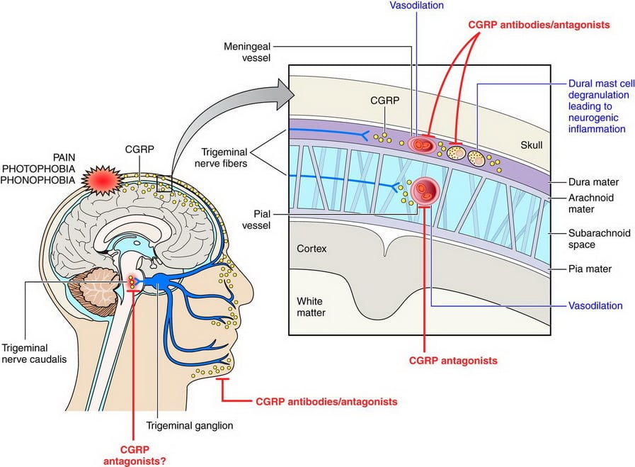 CGRP-mechanisms_migraines_therapy_biotech_neurologicl