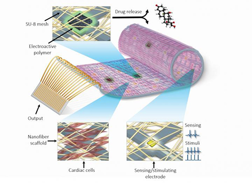 bionic_heart_patch_university_tel_aviv_tau_nanoelectronics_tissue_engineering_myocardial_infarction_heart_attack_nature_materials