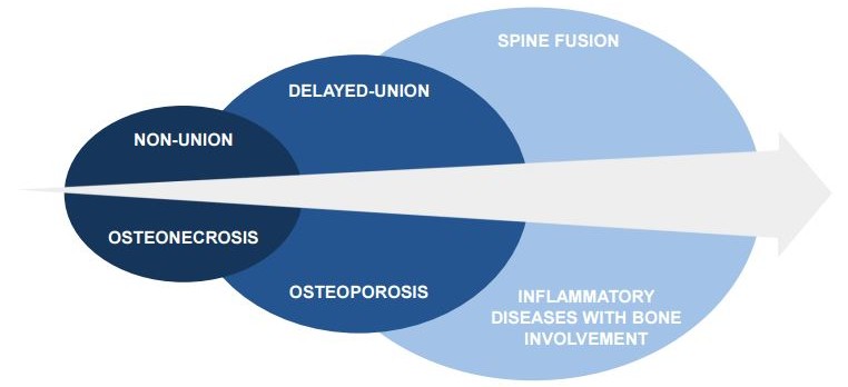 bone_therapeutics_osteoporis_osteocronosis