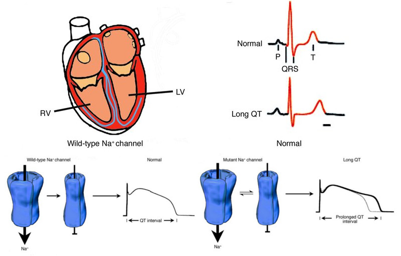 cardiac_risk_drug_discovery_mitrion