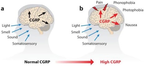 migraine_biotechcgrp_europe_cure_pharma