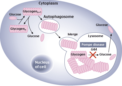 sanofi_genzyme_pompe_disease_enzyme_replacement_therapy_m6p_neoGAAA_NEO1