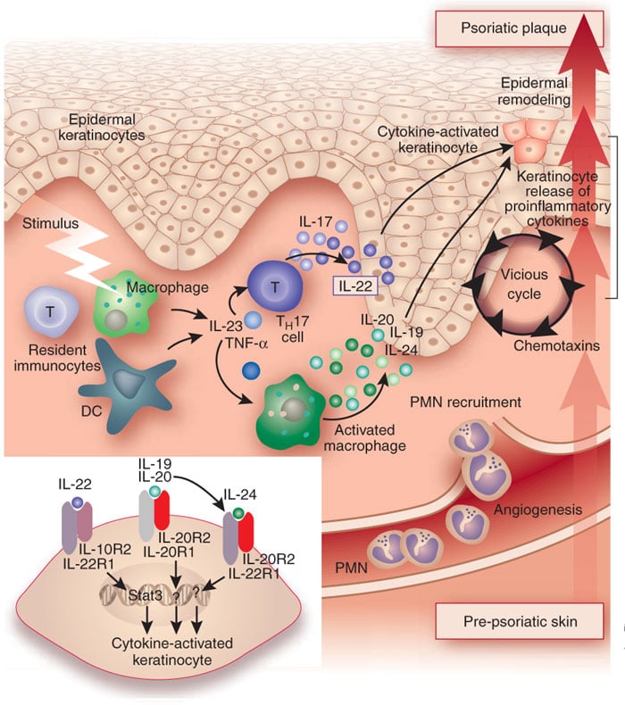 tnf-alpha_necrosis_factor_psoriasis_merck_msb11022_auriel-pso_biosimilar_abbvie_humira