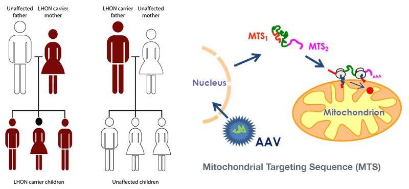 MTS_lhon_aav_gene_therapy_neuropathy_blindness_opthalmology_lebers_gensight