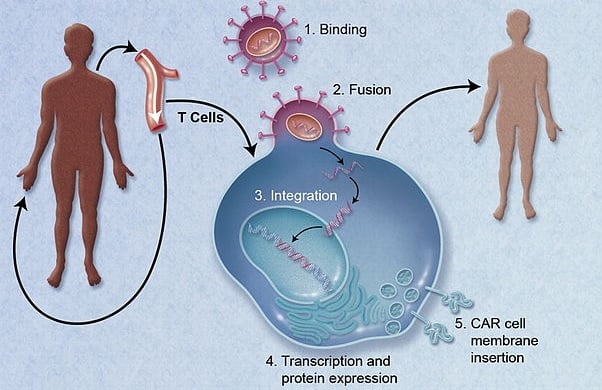 car-treg_txcell_lupus_nephritis_autoimmune