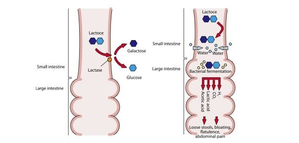 novozymes_saphera_lactase_lactose_intolerance