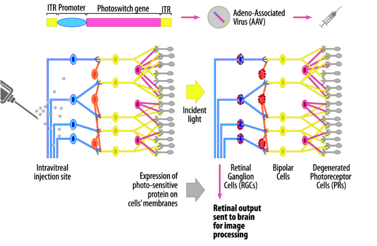 optogenetics_genSiht_biotech_interview_bernard_gilly_LHON_ARMD_retina_optics