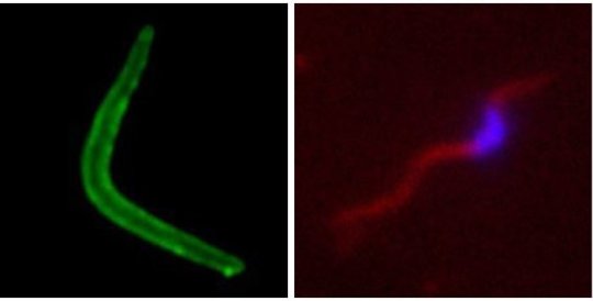 plasmodium_trip_trna_malaria_strasbourg