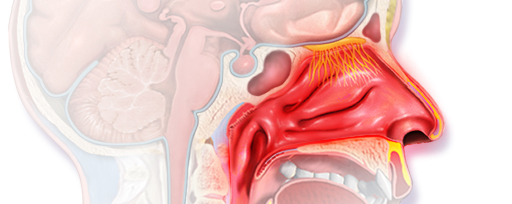 allergy_therapeutics_birch_rhinitis_pollinex