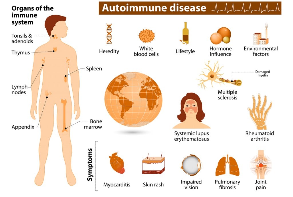 Autoimmune Disease Infographic