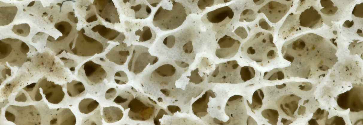 bone therapeutics allob allogeneic osteoporosis