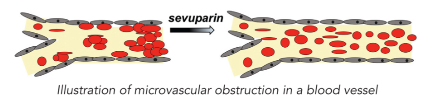 dilaforette_sevuparin_sickle_cell_ergomed_smo_cro_clinical_trial_andrew_mackie