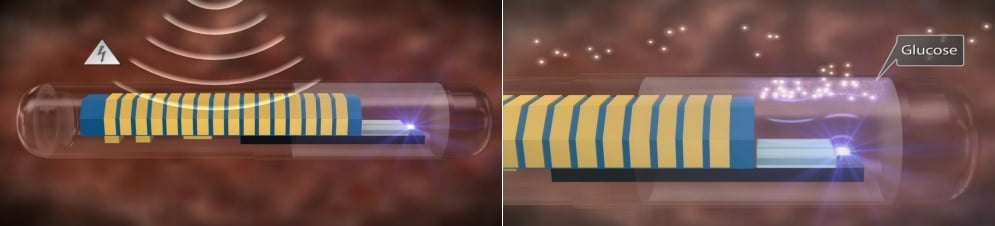 glucose_monitoring_polymer_fluorescent_senseonics