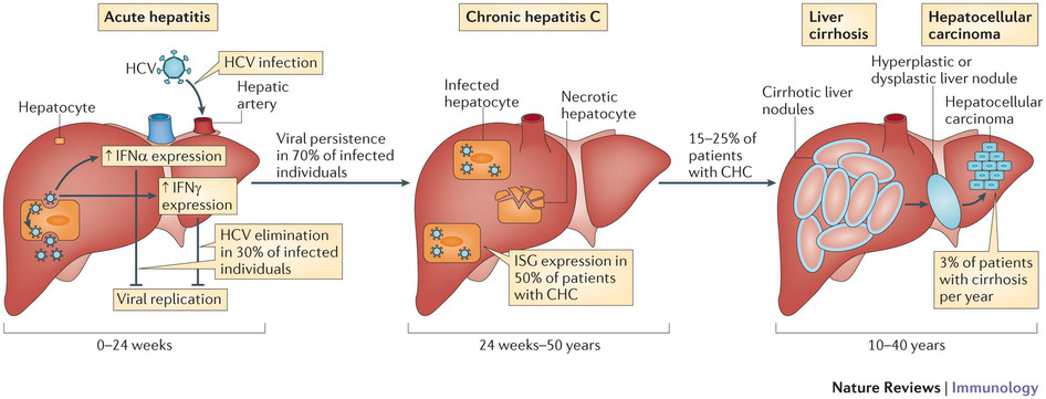 hcv_infection_genotype_cirrhosis_hepatocellular_carcinoma_epistem