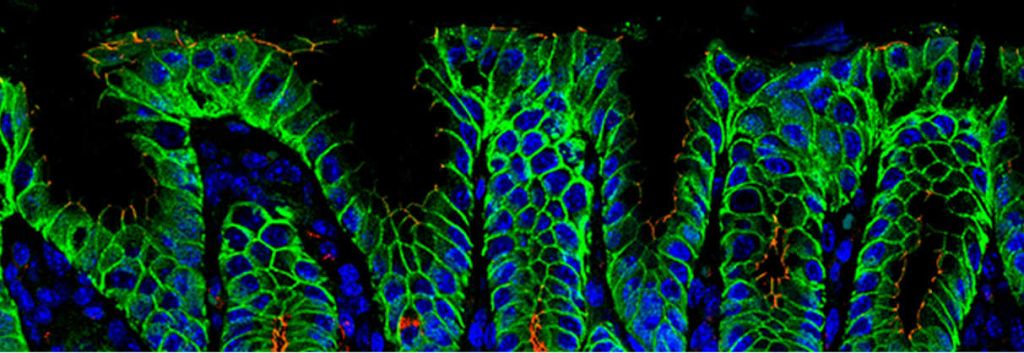 imab ganymed gastroesophegal cancer asco