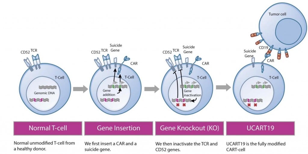 ucart19_cancer_gosh_uk_cellectis_leukemia_baby_therapy_car-t