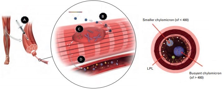 uniqure_glybera_gene_therapy_lipoprotein