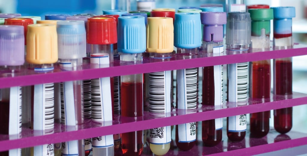 tubes with blood samples in a rack