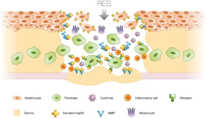 avita_regenercell_chronic_wound_diabetes