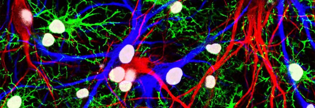 axon neuroscience alzheimer vaccine tau