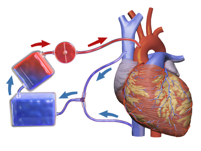 cardiopulmonary_bypass_surgery_inflammation_inflarx